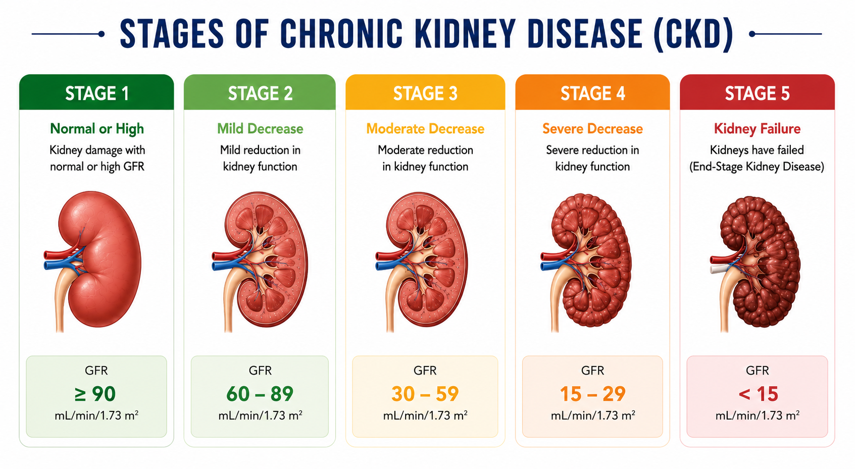 Stages of Chronic Kidney Disease Diagram